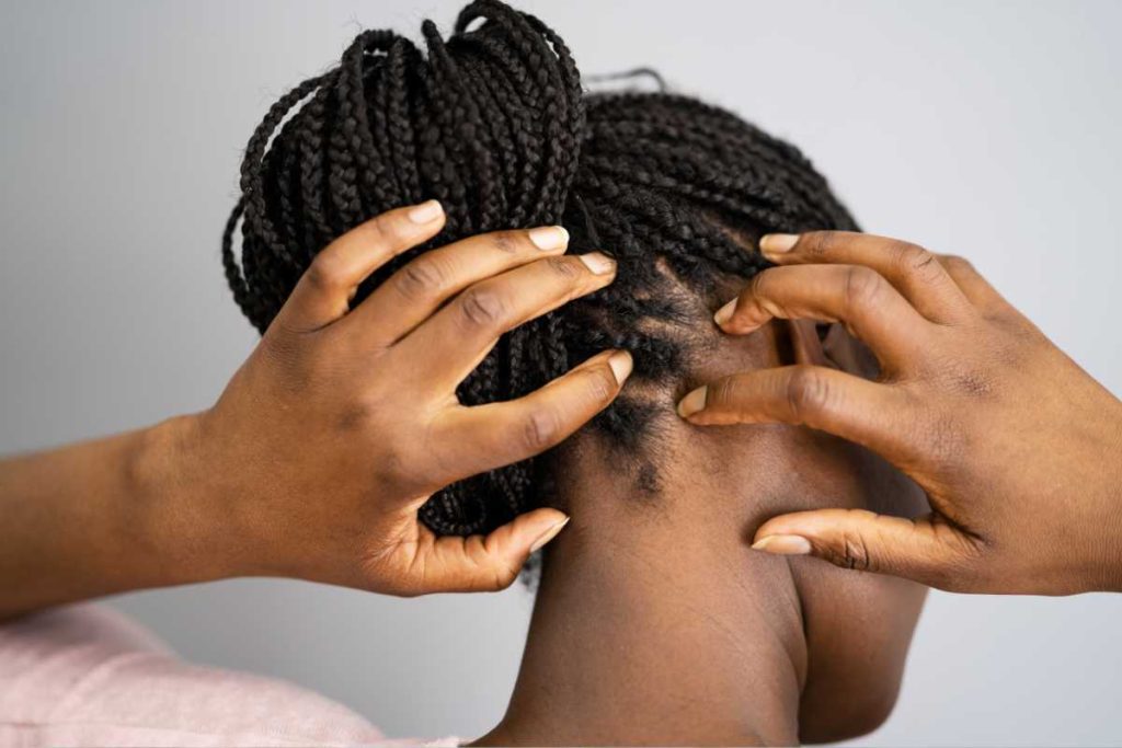 Croute sur le cuir chevelu remèdes de grand-mère